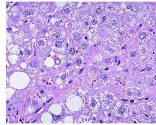 怎么内蒙代孕,在郑州做三代试管婴儿一般要多少钱？只要2600！