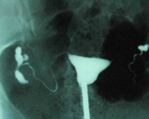 移植40天过危险期了 移植40天已经有胎心胎芽了