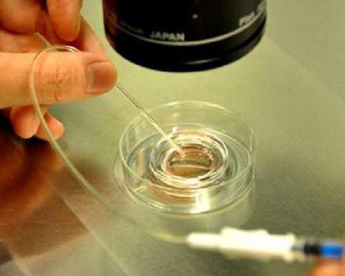 北京朝阳医院做试管婴儿费用高吗多少钱啊