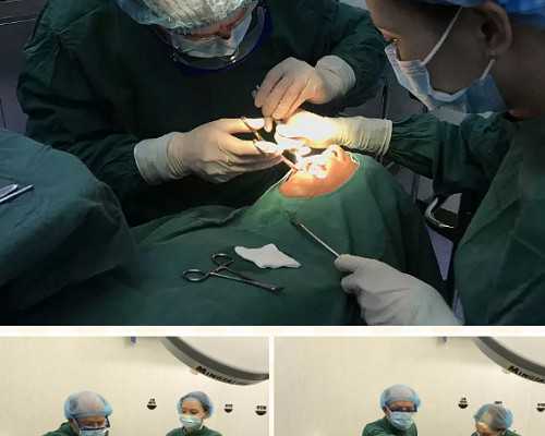 胚胎移植后需要卧床多久？很多人都被误导了