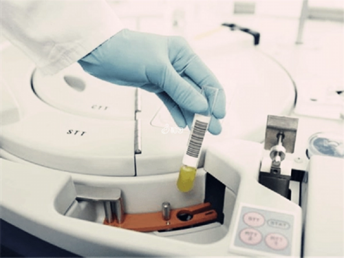 阴道炎患者的饮食宝典：科学饮食助你战胜病魔！